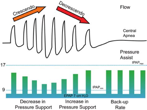 Principles Of Operation Of Servo Ventilation The Air Flow Tracing