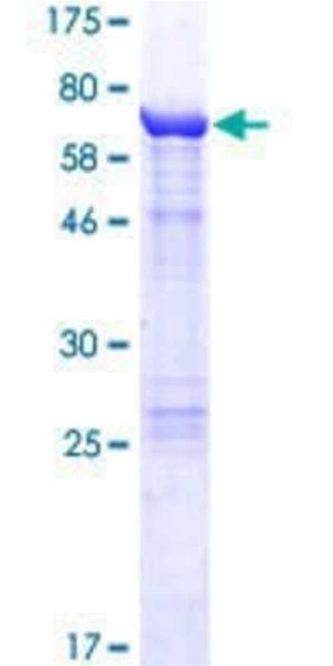 Novus Biologicals Recombinant Human Keratin 36 GST N Term Protein 25