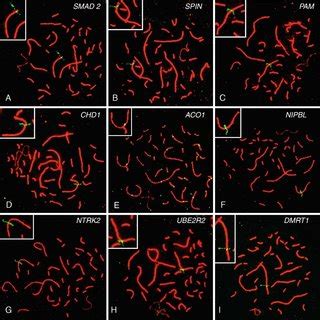 Fish And Immunostaining In Pachytene Spermatocytes Images Of