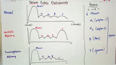 superficial carbón En el piso serum protein electrophoresis Espacioso ...