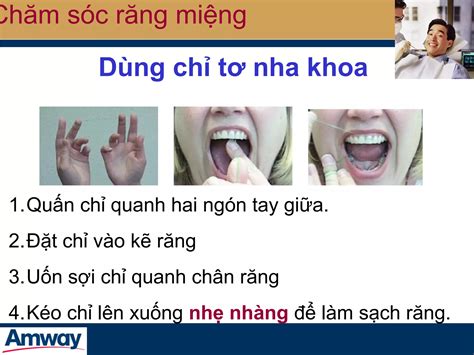 cham soc rang mieng