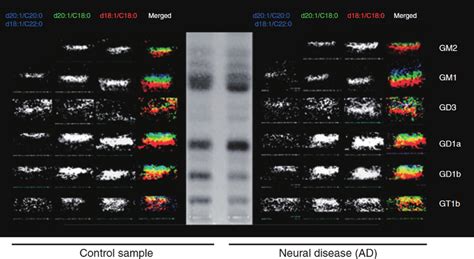 Tlc Blot Maldi Qit Tof Ms Imaging Of Hippocampus Gray Matter