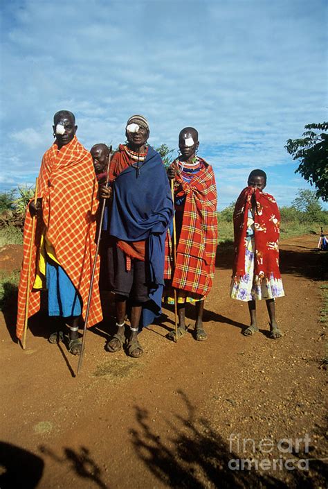 Eye Surgery Patients Photograph By Jason Kelvin Science Photo Library