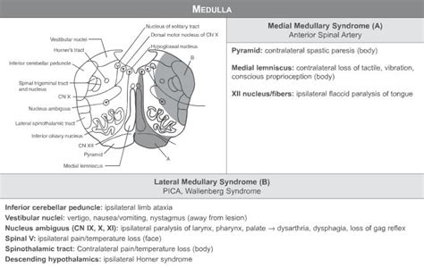 Wallenberg syndrome | Neurology, Syndrome, Nclex