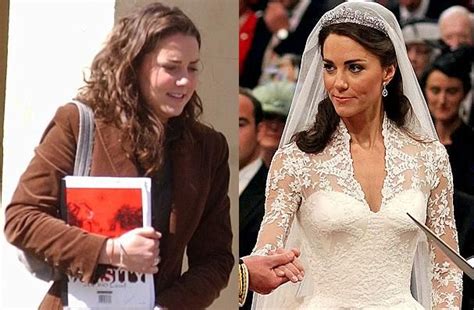 Kate Middleton Before After Beauty Treatments Wedding  607×398