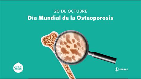 Oct D A Mundial De La Osteoporosis Youtube