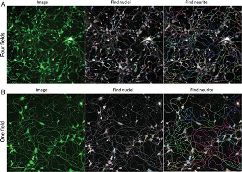 Highthroughput Neurite Outgrowth Assay Using Gfplabeled Ipscderived