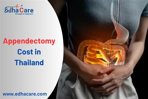 Appendectomy Cost In Thailand Factors And Healthcare Insights