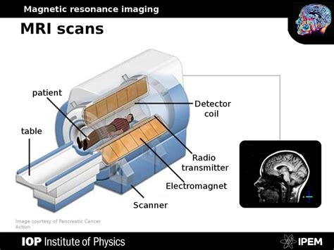 The Role Of Mri Scanners In Capturing Detailed Body Images