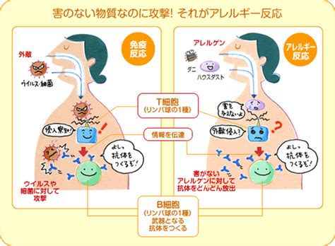 アレルギー疾患｜診療のご案内｜さぎさかクリニック｜浜松市