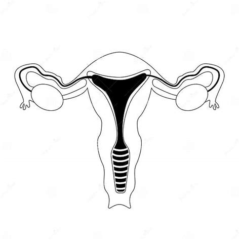 Female Genitals Outline Endometriosis Vector Illustration Stock Vector Illustration Of