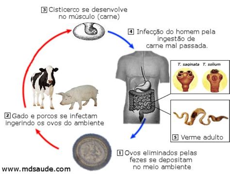 Teníase Ciclo Sintomas e Tratamento MD Saúde