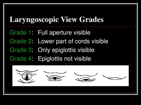 Ppt Orotracheal Intubation Powerpoint Presentation Free Download