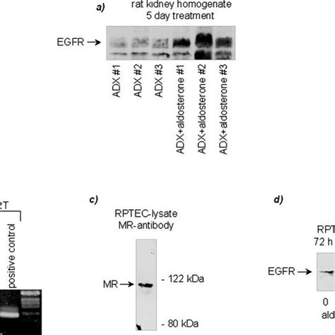 Egfr Expression In Cho Cells Transfected With Hmr A Successful