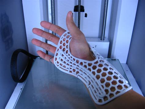 3d друк в медицині Альтернатива гіпсовим повязкам Якісний 3d друк