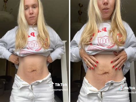 A TikToker Shared What Her Body Looked Like After Pregnancy To Make