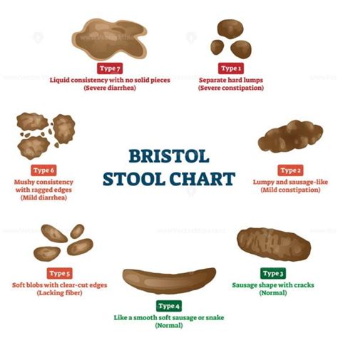 Bristol Stool Chart 7 Types Simple High Resolution Image