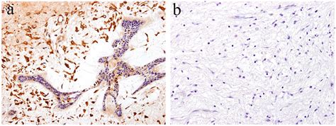 Ijms Free Full Text Notch Signaling Affects Oral Neoplasm Cell