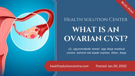 Ovarian Cysts Symptoms Causes And Diagnosis Health Solution Centre