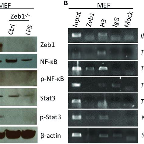 Molecular Mechanisms Underlying Zeb1 Regulation Of Alkali Induced