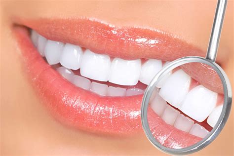 The 12 Best Teeth Lightening Packages Of 2024 Checked And Assessed