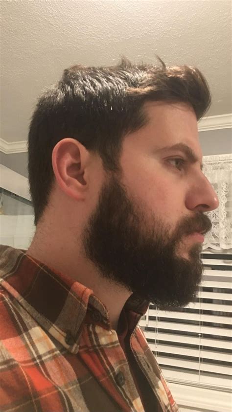 3 Month Beard