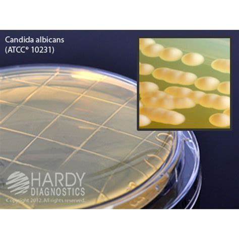 Hardy Diagnostic P80 Dry Culture Media Malt Extract Agar W 001