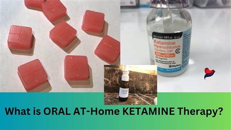 At Home Ketamine Therapy With Oral Ketamine For Depression I Tried