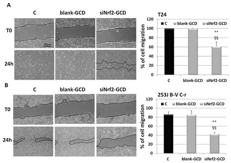 Cell Migration Wound Healing Assay At 0 T0 And At 24 H In T24 A