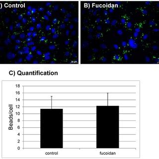 Primary Rpe Cells A And Arpe Cells B Were Treated With G Ml