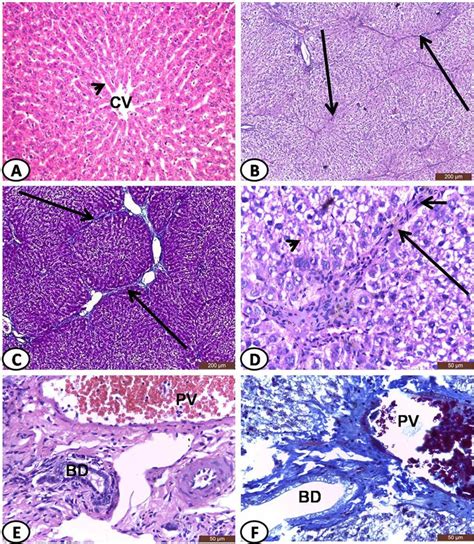 Representative Photomicrographs Of Livers Obtained From Control Download Scientific Diagram