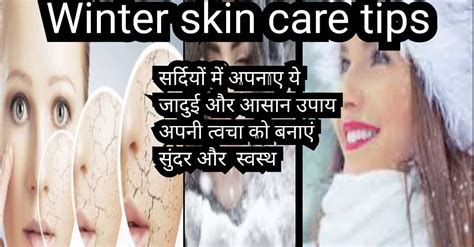 Winter Skin Care Tips I सर्दियों में ये नुस्खे आपके त्वचा और शरीर के