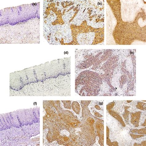 Immunohistochemical analysis of TG2 a b c NF κ B d e and