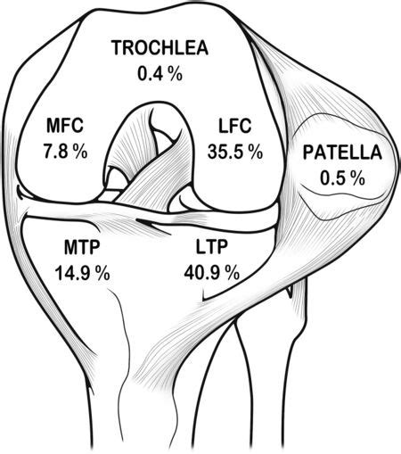 Anterior Cruciate Ligament Acl Injury Physiopedia