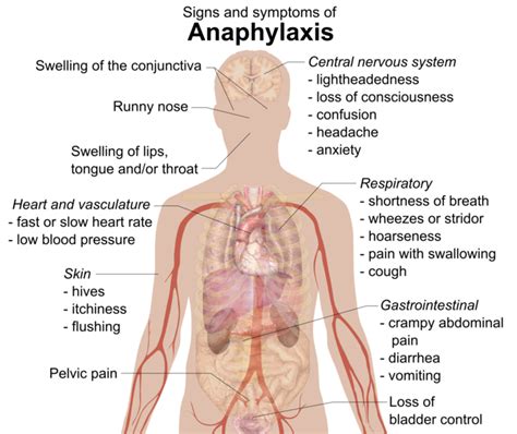 124a Type I Anaphylactic Reactions Biology Libretexts