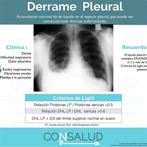 Derrame Pleural Fotos