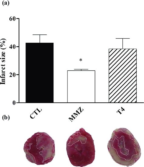 Measurement Of Infarct Size Percentage Of Infarcted Area In Relation