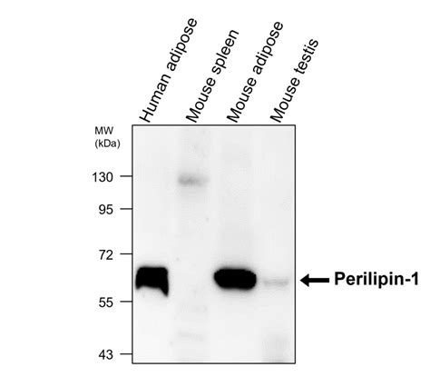 Adipogenesis Marker Antibody Panel IRAP5026 IReal Biotechnology Inc