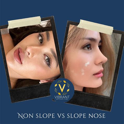 Beverly Hills Medical Group - Do you have sharp pain caused by a foot