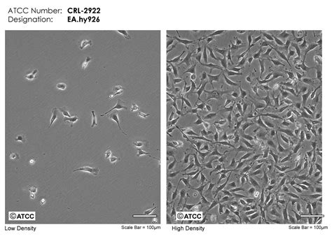 Eahy926细胞atcc Crl 2922细胞 Eahy926人脐静脉细胞融合细胞株购买价格、培养基、培养条件、细胞图片、特征等基本信息生物风