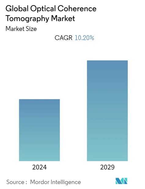 광 간섭 단층 촬영 시장 OCT 규모 공유 및 분석
