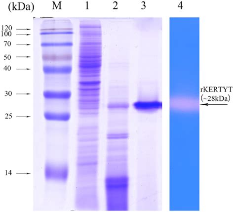 SDS PAGE And Zymogram Analysis Of Recombinant Keratinase M Protein MW