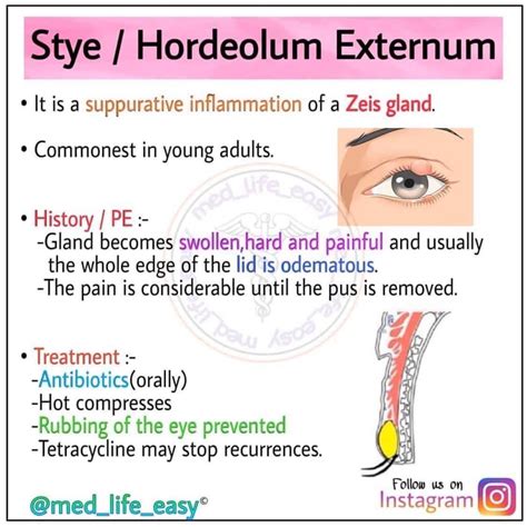 Zeis gland - MEDizzy