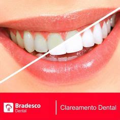 Ideias De Odontologia Odontologia Desenho Marketing Odontol Gico