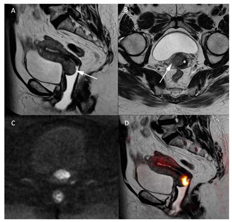 Jcm Free Full Text Diffusion Weighted Mri In The Genitourinary System