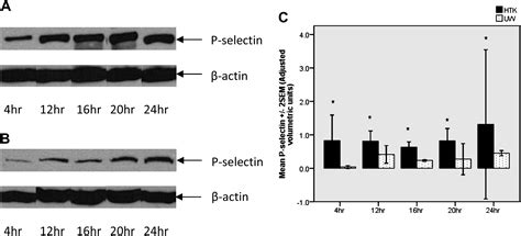 P Selectin Expression In Cold Preserved Kidneys In University Of