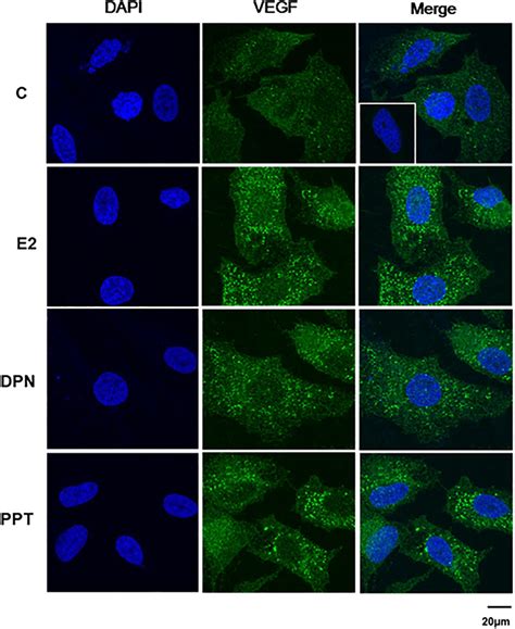 Frontiers Estrogen Receptors Promote Migration Invasion And Colony