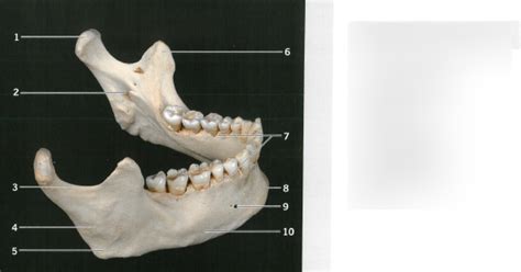 Mandible Right Lateral View Diagram Quizlet