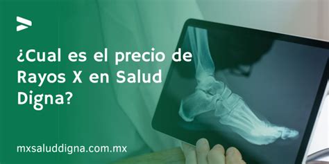 Cual Es El Precio De Rayos X En Salud Digna Salud Digna