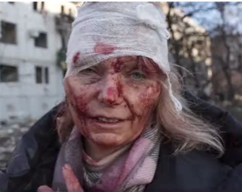 Guerra Russia Ucraina Donna Ferita Dago Fotogallery